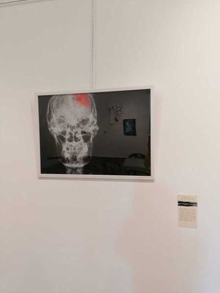 mostra-stroke-3