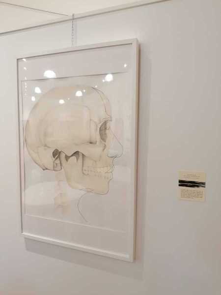 mostra-stroke-8
