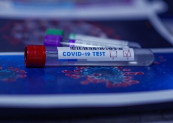 Coronavirus: in Abruzzo 1639 nuovi casi, 8 i deceduti