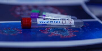 Coronavirus: in Abruzzo 1639 nuovi casi, 8 i deceduti