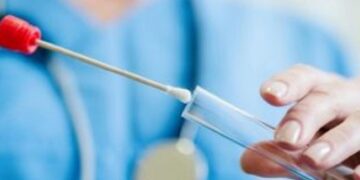 Covid-19, oggi in Abruzzo più guariti che contagiati. Tasso di positività sotto il 10%