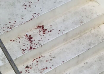 Cercano di sedare litigio, ma vengono aggrediti: due giovani feriti a Vasto Marina