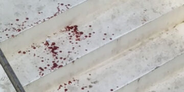 Cercano di sedare litigio, ma vengono aggrediti: due giovani feriti a Vasto Marina