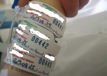 Raro parto trigemellare a Chieti: nate Alice, Amanda e Arianna