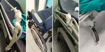 Barelle “incerottate” e carrozzine sgonfie: «Per noi del Pronto soccorso una difficile quotidianità»
