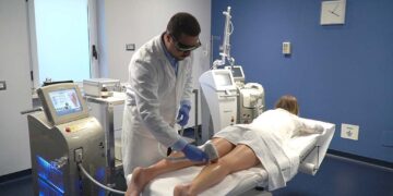 Col Dottor Luca Memmo parliamo di epilazione definitiva con “Alma Laser Soprano Ice Platinum”