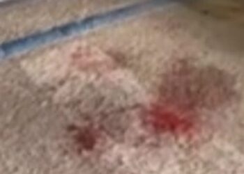 «Mio figlio aggredito da 20 ragazzi, aiutatemi a rintracciarli»