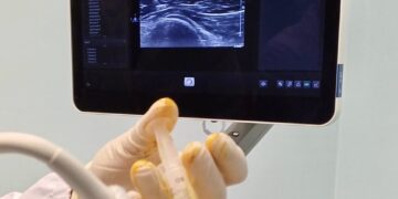 Artrosi e patologie dei legamenti si curano meglio a Chieti con le infiltrazioni guidate da ecografia