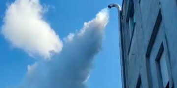 Al “Renzetti” di Lanciano nuova risonanza magnetica, durante i lavori esami a Vasto