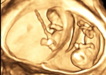 Boom di nascite gemellari all’ospedale di Chieti