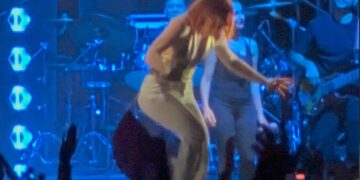 Caduta dal palco durante il concerto: per Noemi fratture non gravi, 30 giorni di prognosi